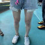 Legs